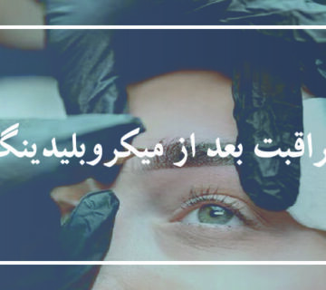 مراقبت های بعد از میکروبلیدینگ