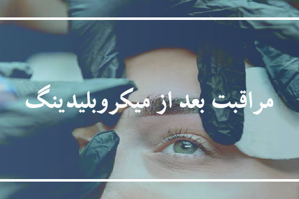 مراقبت های بعد از میکروبلیدینگ